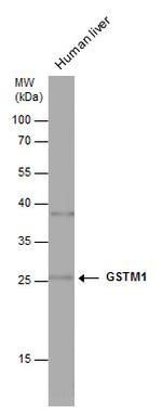 GSTM1 Antibody in Western Blot (WB)