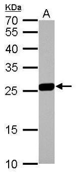 GSTM1 Antibody in Western Blot (WB)