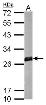 GSTM1 Antibody in Western Blot (WB)