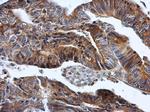 HPRT1 Antibody in Immunohistochemistry (Paraffin) (IHC (P))