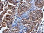 HPRT1 Antibody in Immunohistochemistry (Paraffin) (IHC (P))