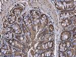 HPRT1 Antibody in Immunohistochemistry (Paraffin) (IHC (P))