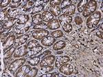 HPRT1 Antibody in Immunohistochemistry (Paraffin) (IHC (P))