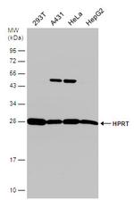 HPRT1 Antibody in Western Blot (WB)