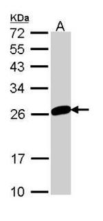 MAD2 Antibody in Western Blot (WB)