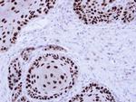 NuMA Antibody in Immunohistochemistry (Paraffin) (IHC (P))