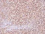 PSMA6 Antibody in Immunohistochemistry (Paraffin) (IHC (P))