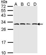 PSMA6 Antibody in Western Blot (WB)