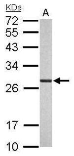 PSMA6 Antibody in Western Blot (WB)