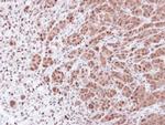 PSMA7 Antibody in Immunohistochemistry (Paraffin) (IHC (P))