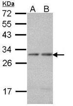 PSMA7 Antibody in Western Blot (WB)