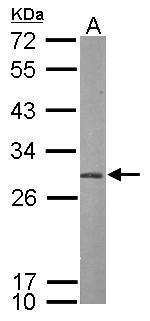 PSMA7 Antibody in Western Blot (WB)