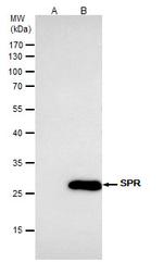 SPR Antibody in Immunoprecipitation (IP)