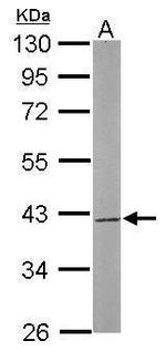 SAE1 Antibody in Western Blot (WB)