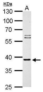 SAE1 Antibody in Western Blot (WB)