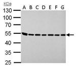 ASL Antibody in Western Blot (WB)