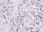 HUS1 Antibody in Immunohistochemistry (Paraffin) (IHC (P))