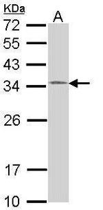 HUS1 Antibody in Western Blot (WB)