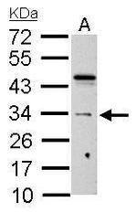 HUS1 Antibody in Western Blot (WB)