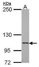 CD41 Antibody in Western Blot (WB)