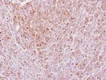 Laminin gamma-2 Antibody in Immunohistochemistry (Paraffin) (IHC (P))