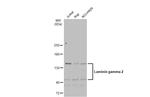 Laminin gamma-2 Antibody in Western Blot (WB)