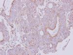 NDUFS1 Antibody in Immunohistochemistry (Paraffin) (IHC (P))