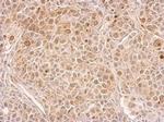 CIAPIN1 Antibody in Immunohistochemistry (Paraffin) (IHC (P))