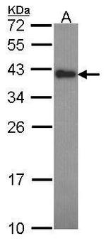 CIAPIN1 Antibody in Western Blot (WB)