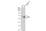 GBA Antibody in Western Blot (WB)