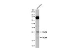 RGS4 Antibody in Western Blot (WB)