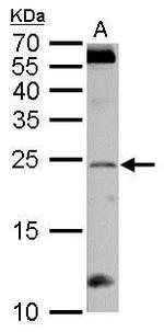 RGS4 Antibody in Western Blot (WB)