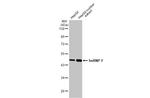 hnRNP F Antibody in Western Blot (WB)