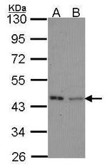 IVD Antibody in Western Blot (WB)