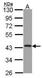 NDUFA10 Antibody in Western Blot (WB)