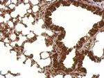 PCBP2 Antibody in Immunohistochemistry (Paraffin) (IHC (P))