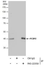 PCBP2 Antibody in Immunoprecipitation (IP)