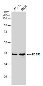 PCBP2 Antibody in Western Blot (WB)