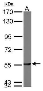 PGM3 Antibody in Western Blot (WB)