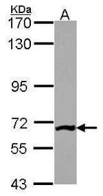 PGM3 Antibody in Western Blot (WB)