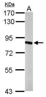 HSD17B4 Antibody in Western Blot (WB)