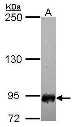 SFMBT1 Antibody in Western Blot (WB)