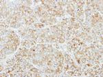 CSDE1 Antibody in Immunohistochemistry (Paraffin) (IHC (P))