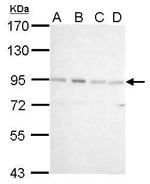 CSDE1 Antibody in Western Blot (WB)