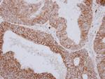 PNPase Antibody in Immunohistochemistry (Paraffin) (IHC (P))