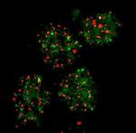 FANCD2 Antibody in Immunocytochemistry (ICC/IF)