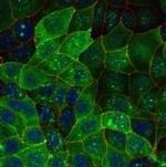 Aquaporin 2 Antibody in Immunocytochemistry (ICC/IF)