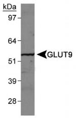 GLUT9 Antibody in Western Blot (WB)