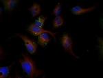 LDLR Antibody in Immunocytochemistry (ICC/IF)