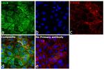 LDLR Antibody in Immunocytochemistry (ICC/IF)